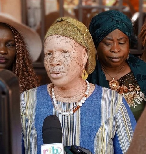 1)	Maïmouna Déné, présidente de l’Association des Femmes Albinos du Burkina (AFAB)